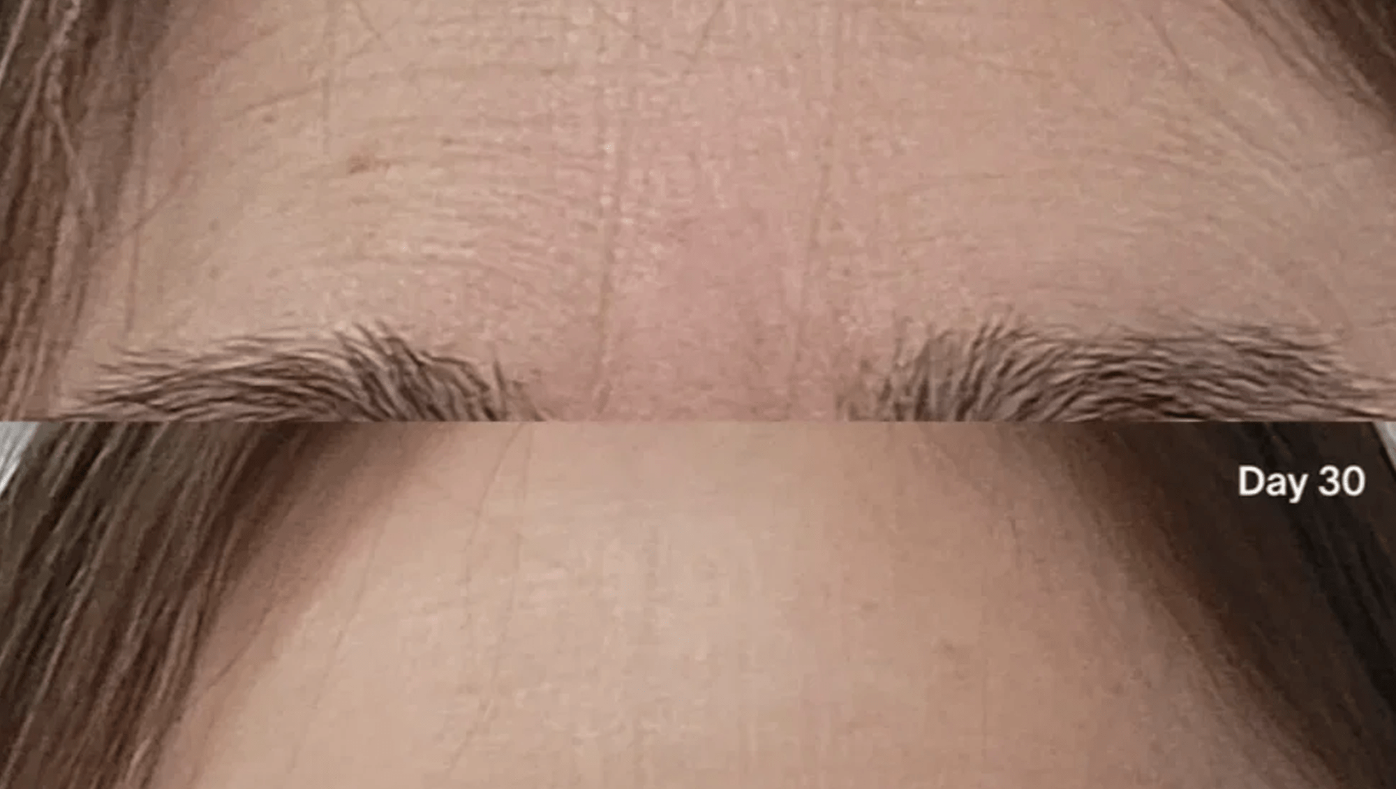Wrinkles Between Your Brows? This 3-Minute Fix Takes Years Off