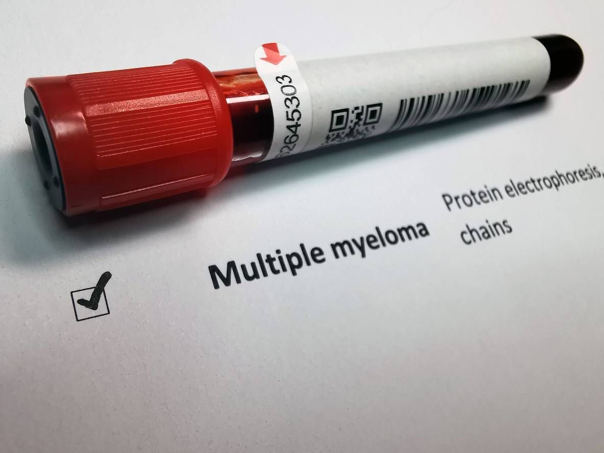 What You Need To Know About Multiple Myeloma