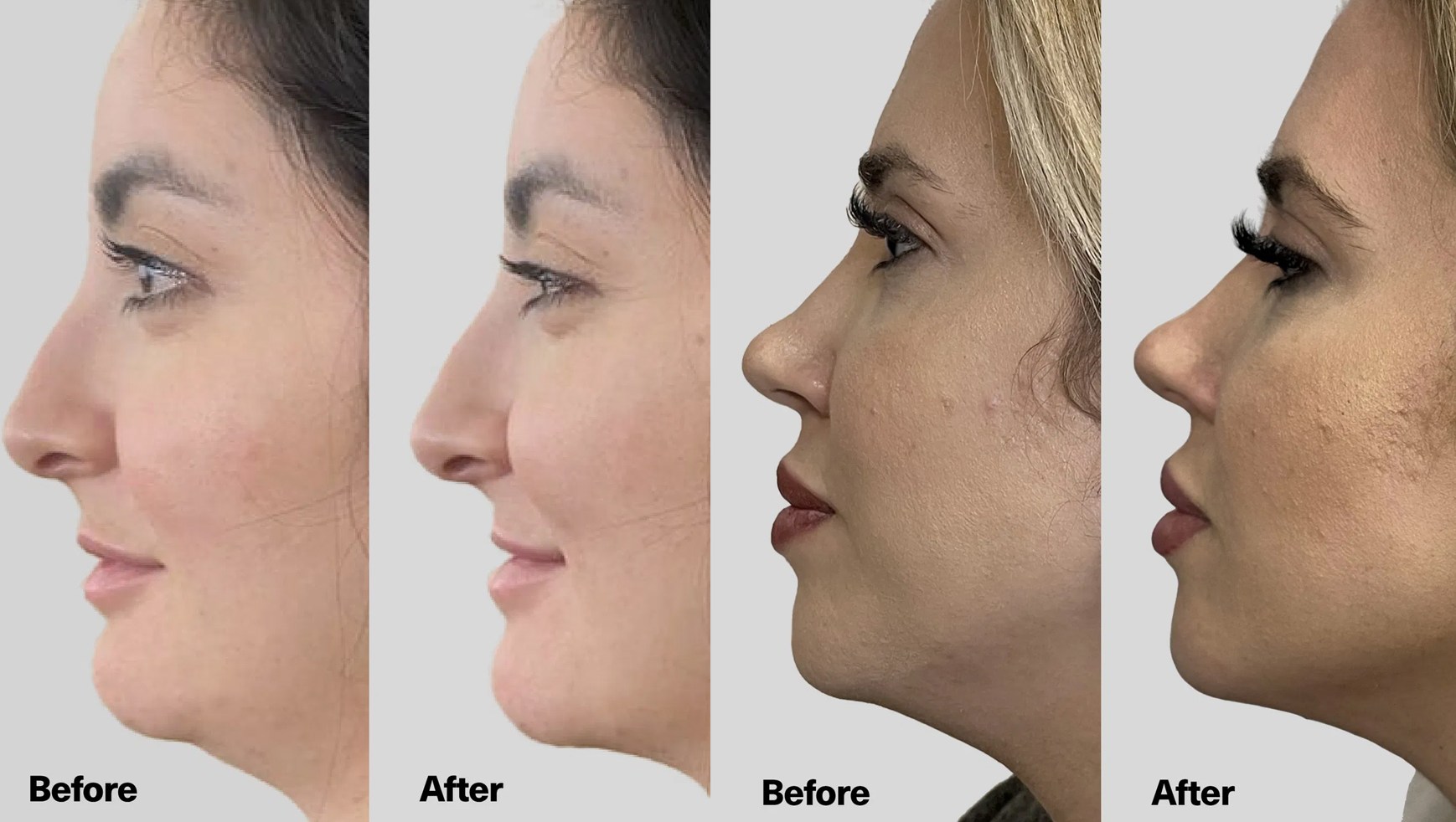 Skip the Botox and Fillers: This Jaw Defining Serum Takes a Decade off Your Face