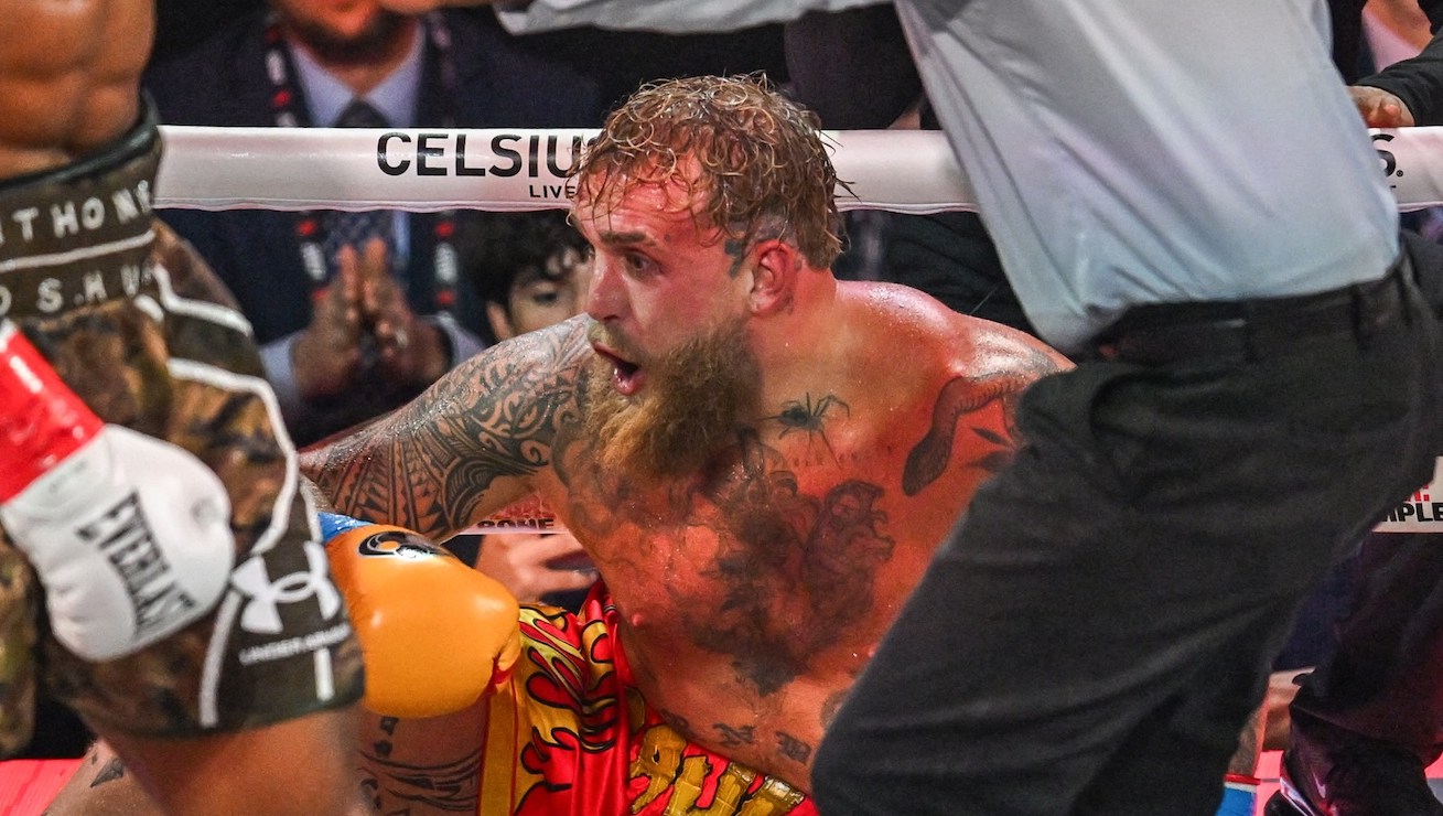 Jake Paul in Hospital with ‘Double Broken Jaw’ After Losing Netflix Fight