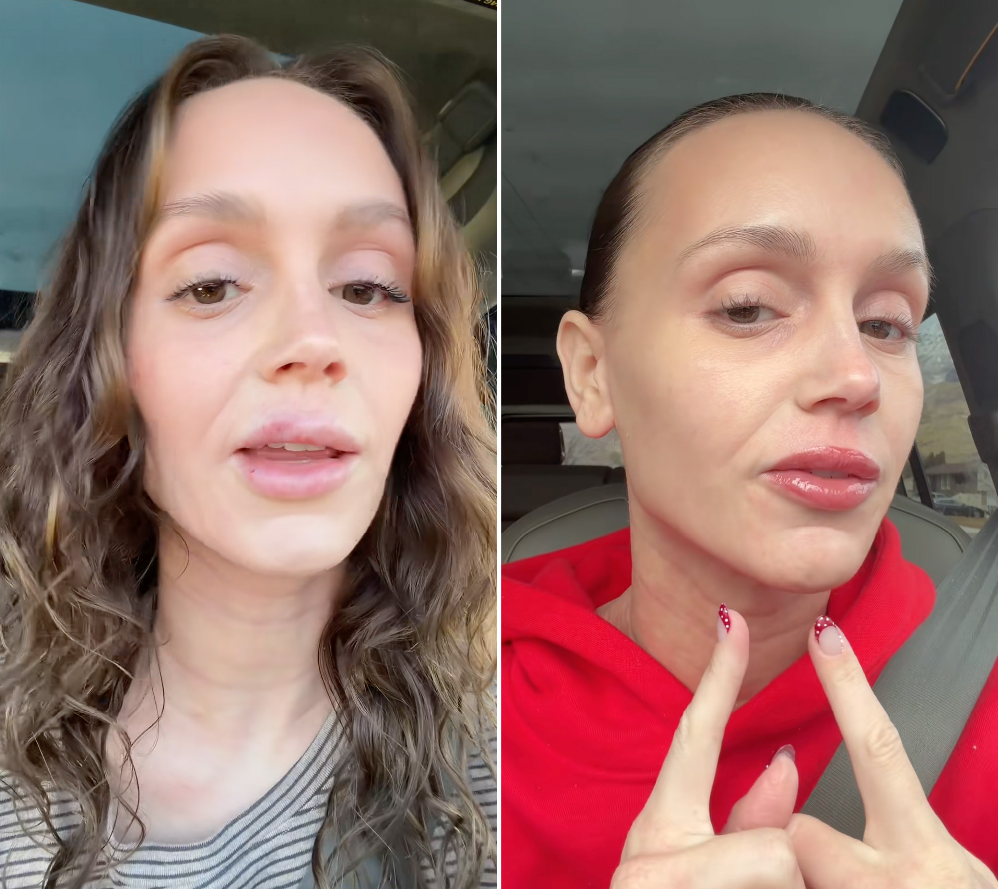 Mormon Wives’ Mikayla Matthews Shares Why She Dissolved All of Her Lip Filler