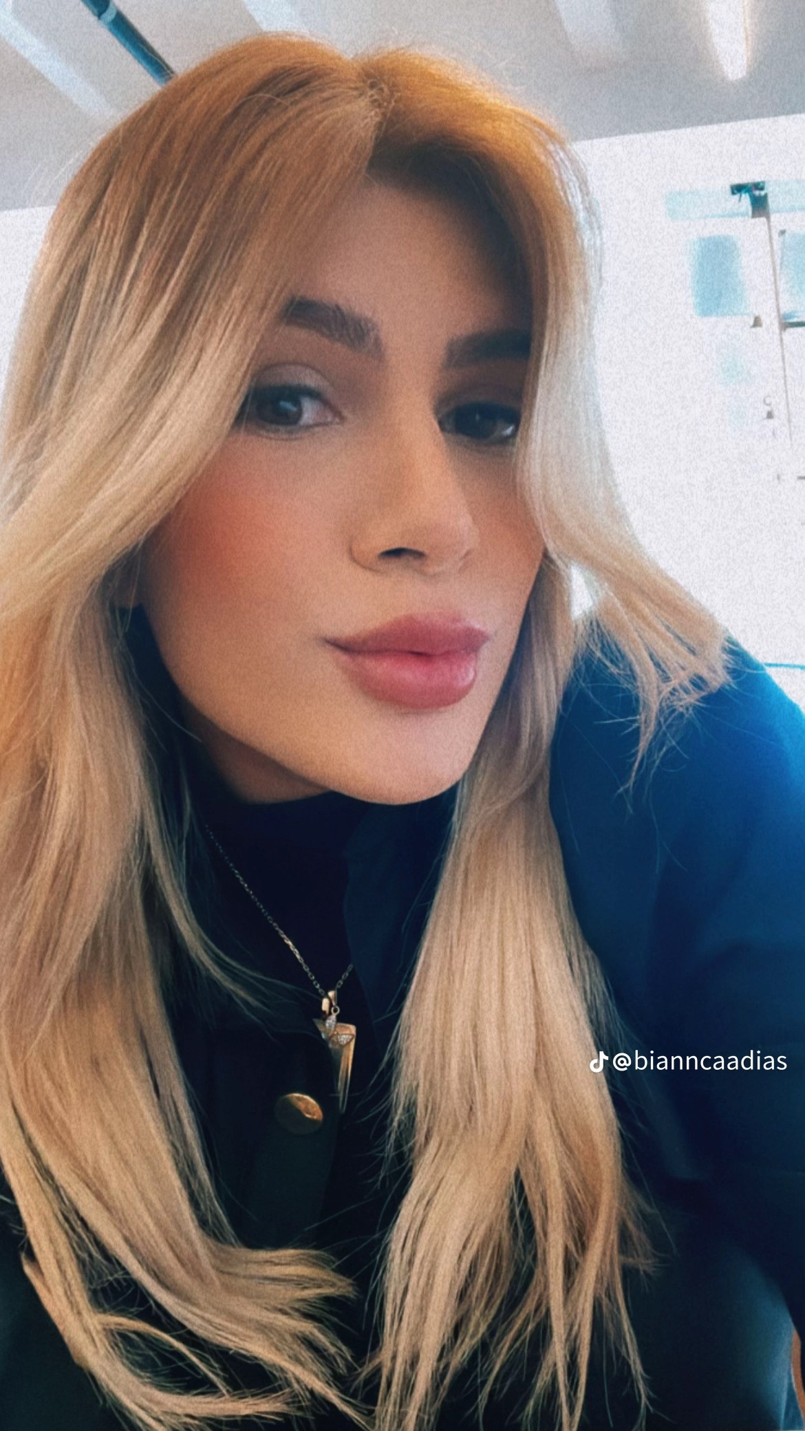 Influencer Bianca Dias Dies Days After Undergoing Cosmetic Surgery Procedure