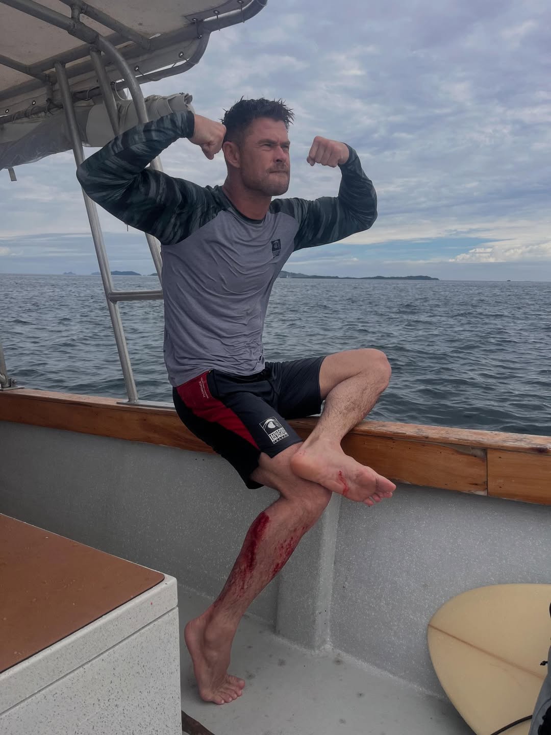 Chris Hemsworth Reveals Brutal Leg Injury on Fiji Surfing Trip With Family