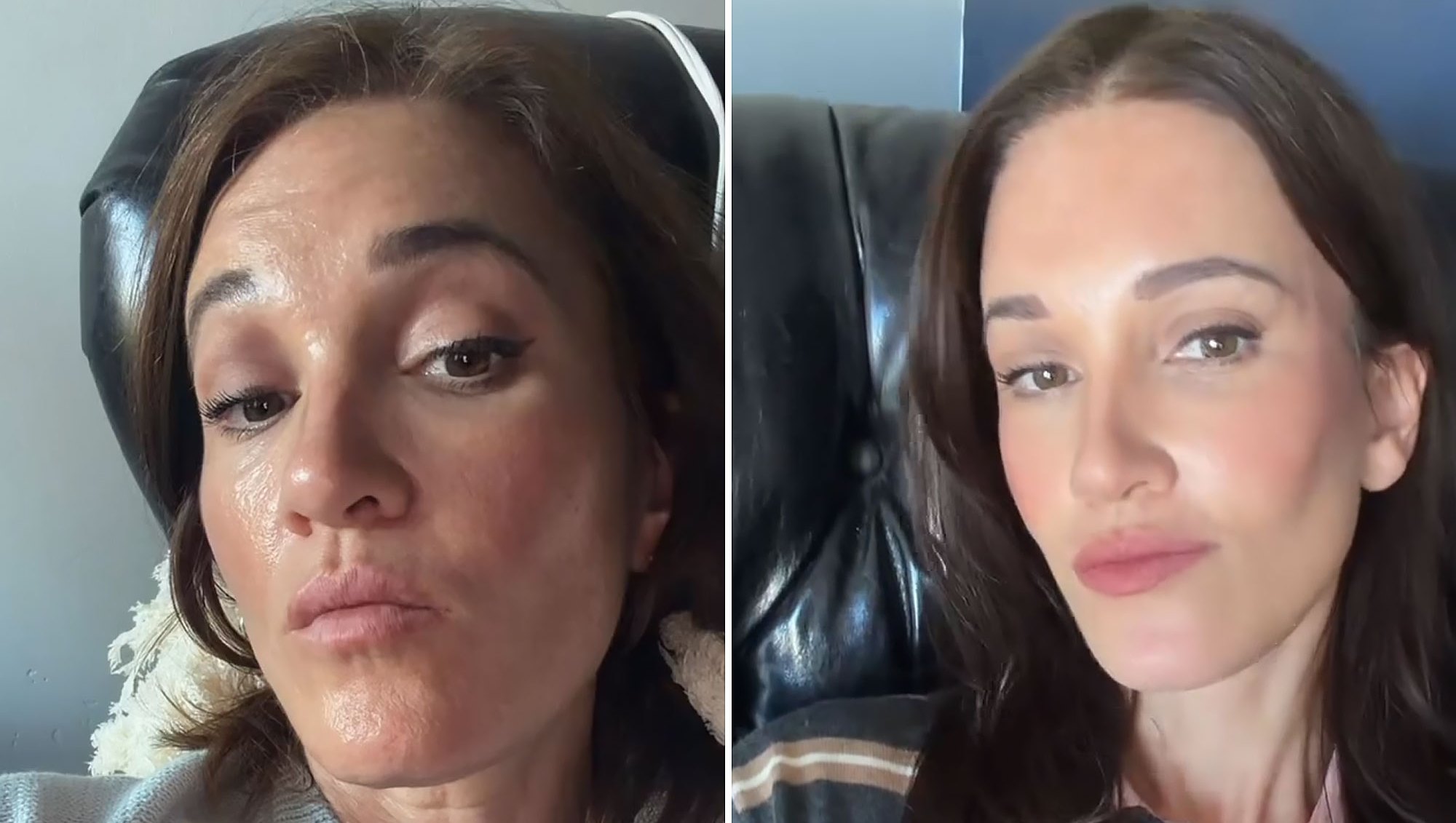 Influencer Katie Anderson Shows Off 2nd Facelift Results at 48: ‘So Glad’