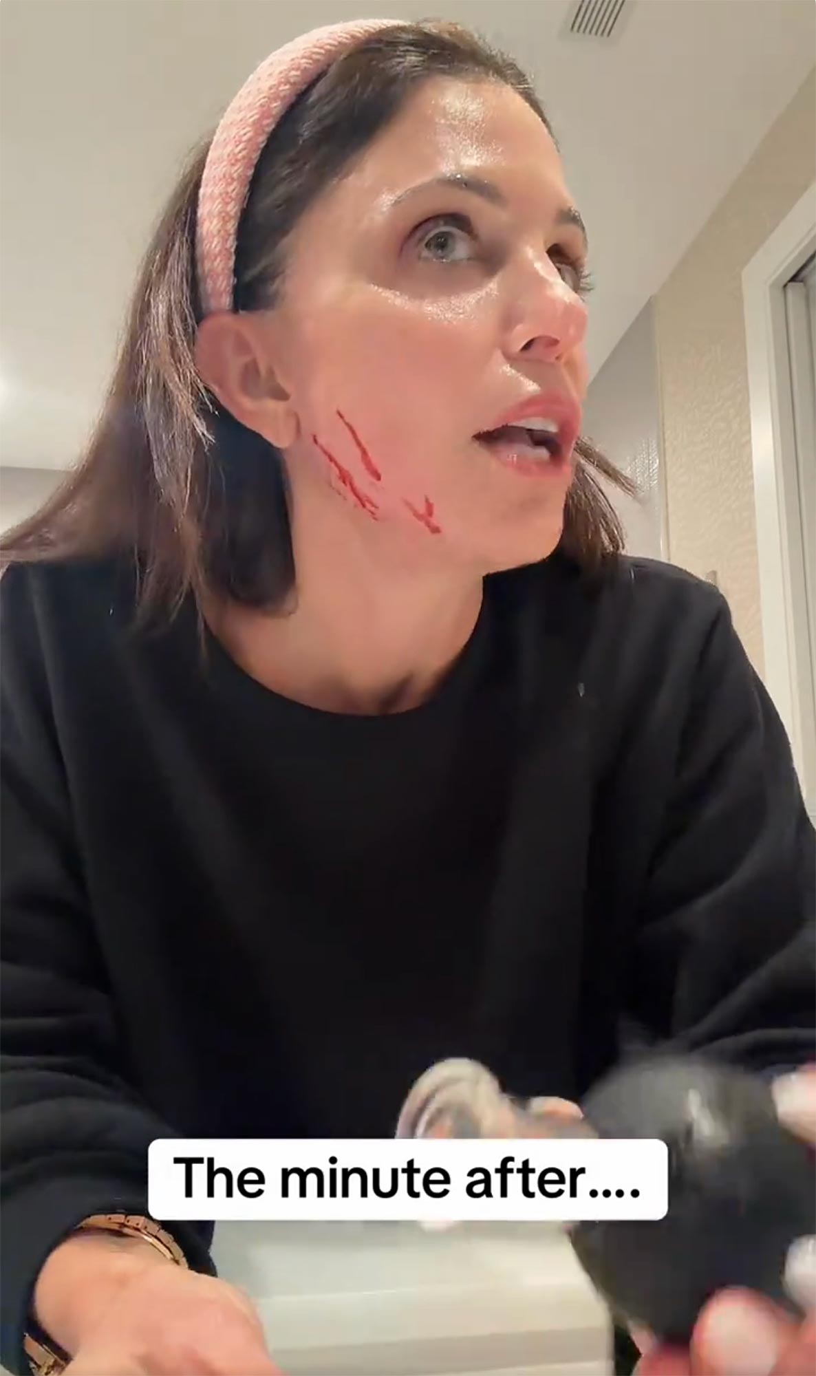 What Happened to Bethenny Frankel’s Face? Nurse Jamie Controversy Explained