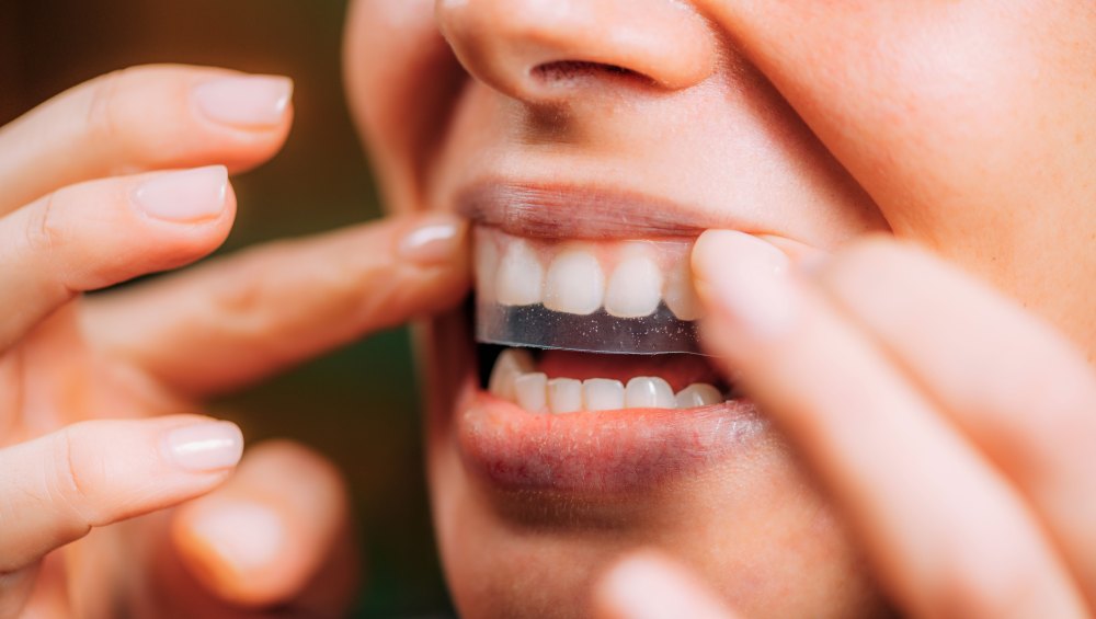 Run! These Bestselling Whitening Strips Just Hit Their Lowest Price of the Year