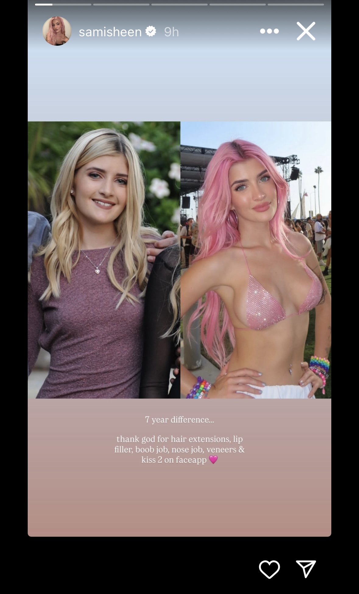 Sami Sheen Defends Listing All of Her Cosmetic Surgery Procedures