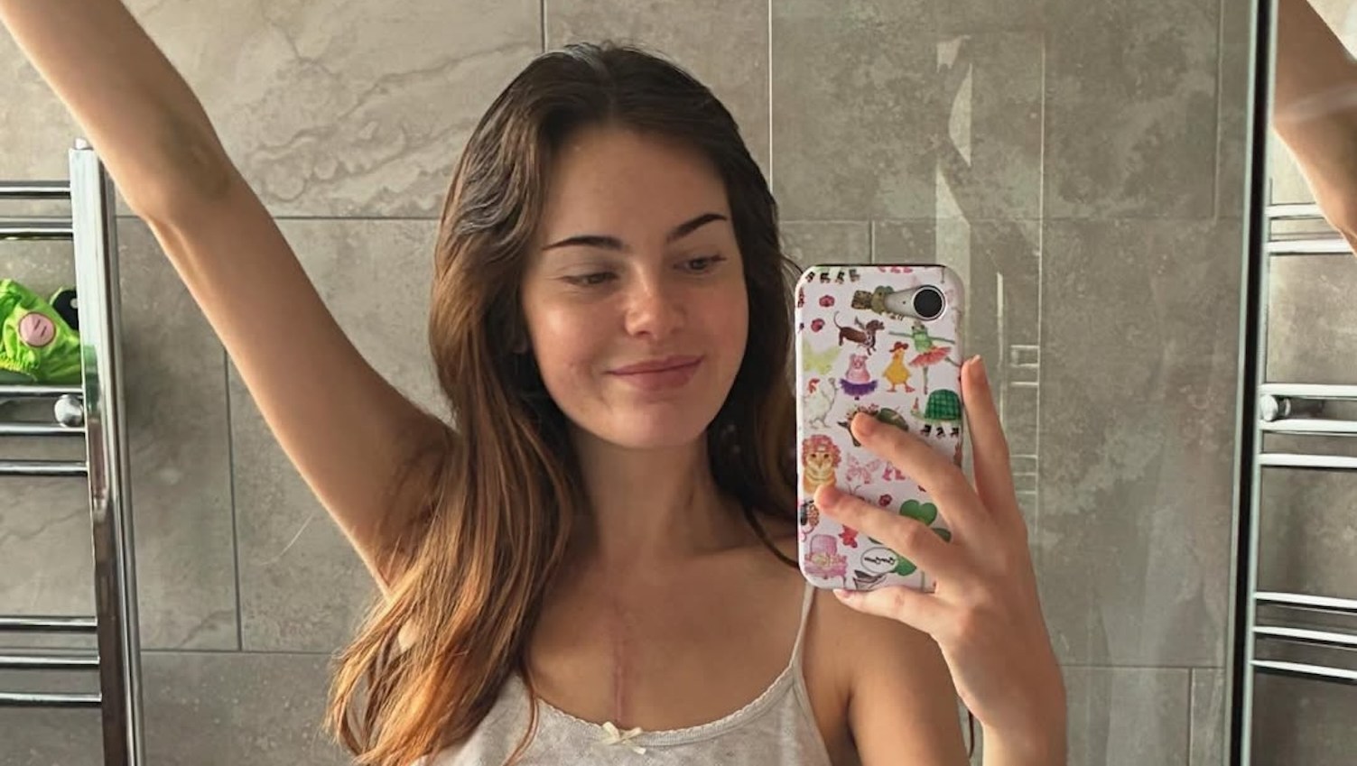 Influencer Reflects on Heart Transplant After Heart Attack at Age 24