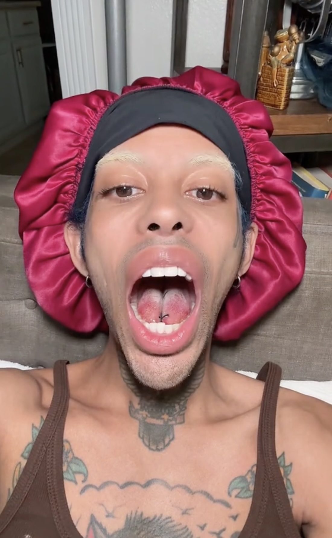 TikTok Star Shares Before and After Videos of Tongue-Splitting Surgery