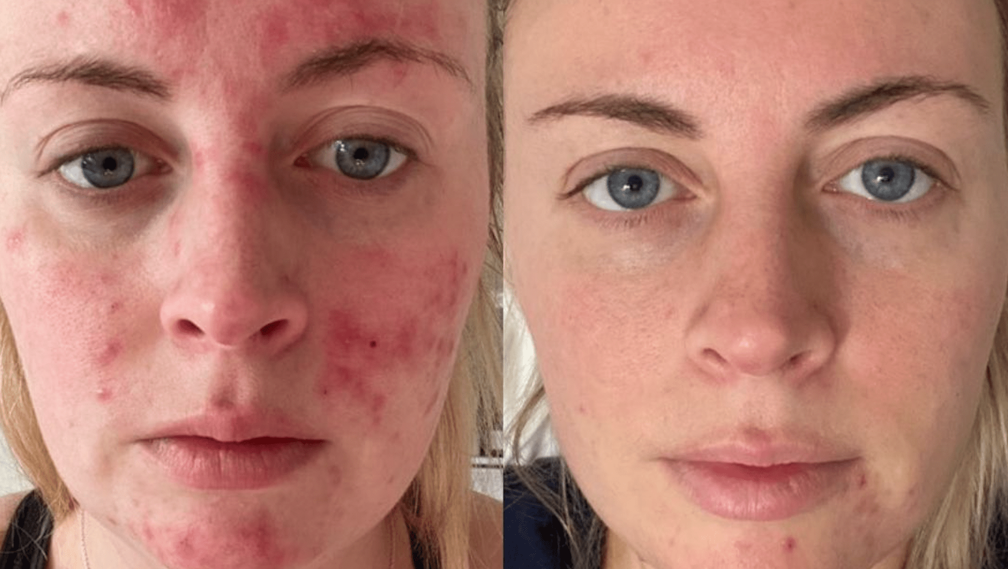 Blemishes and Scars? This Repair Serum Targets Both in One Simple Step